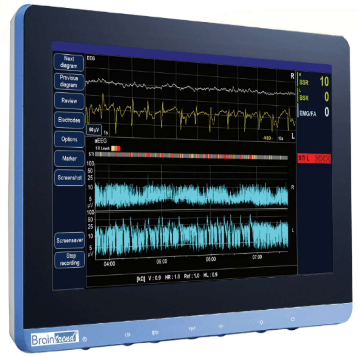 BrainTrend NarcoTrend Medical monitor displaying EEG and other physiological data on a screen.