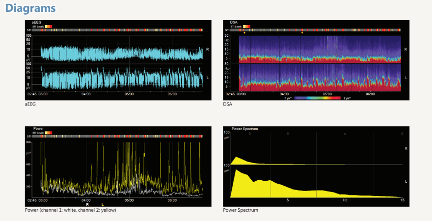 Braintrend Monitor –  EEG Monitoring System for Neonatology - NC-0502-BT