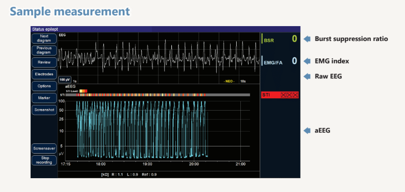 Braintrend Monitor –  EEG Monitoring System for Neonatology - NC-0502-BT