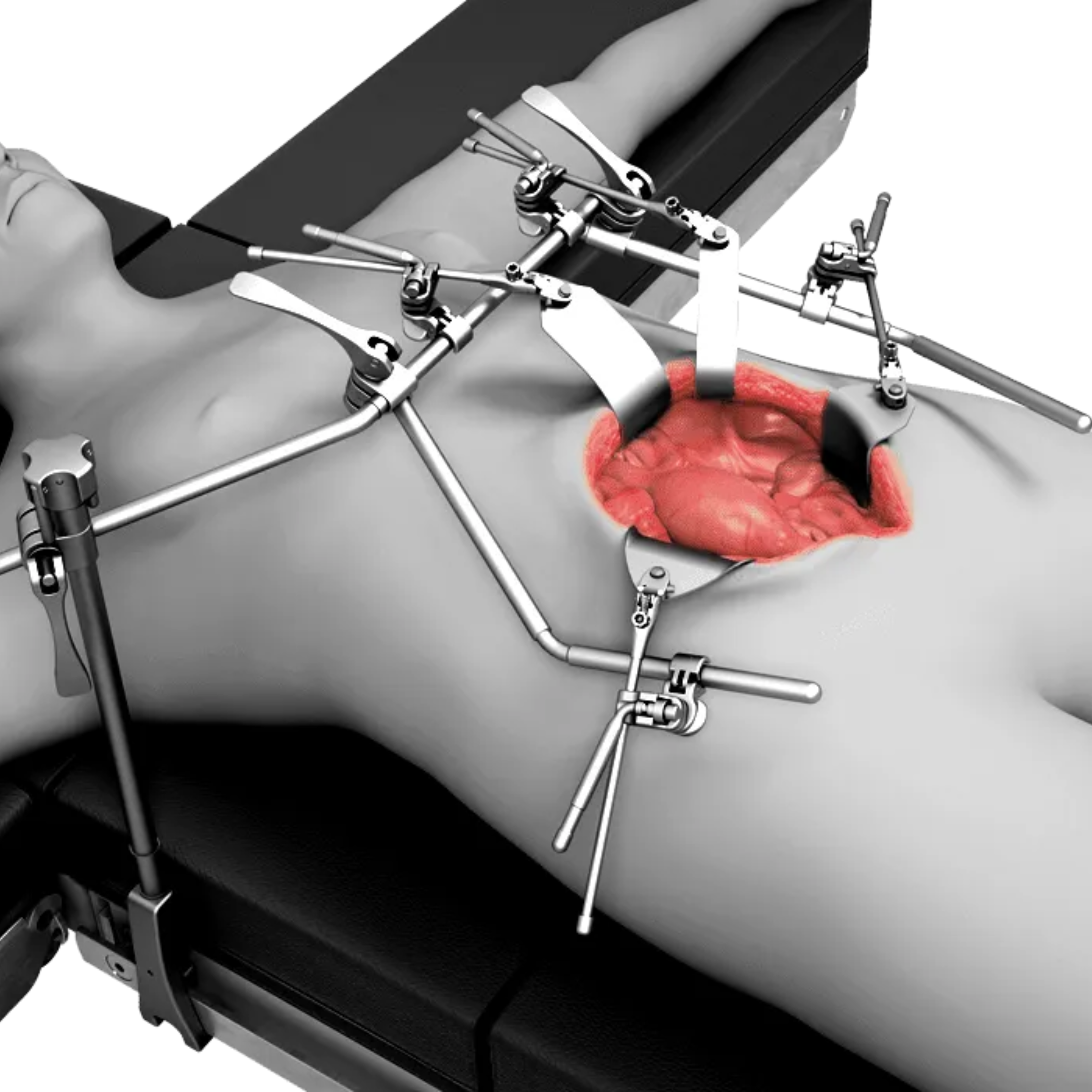 General / Vascular System