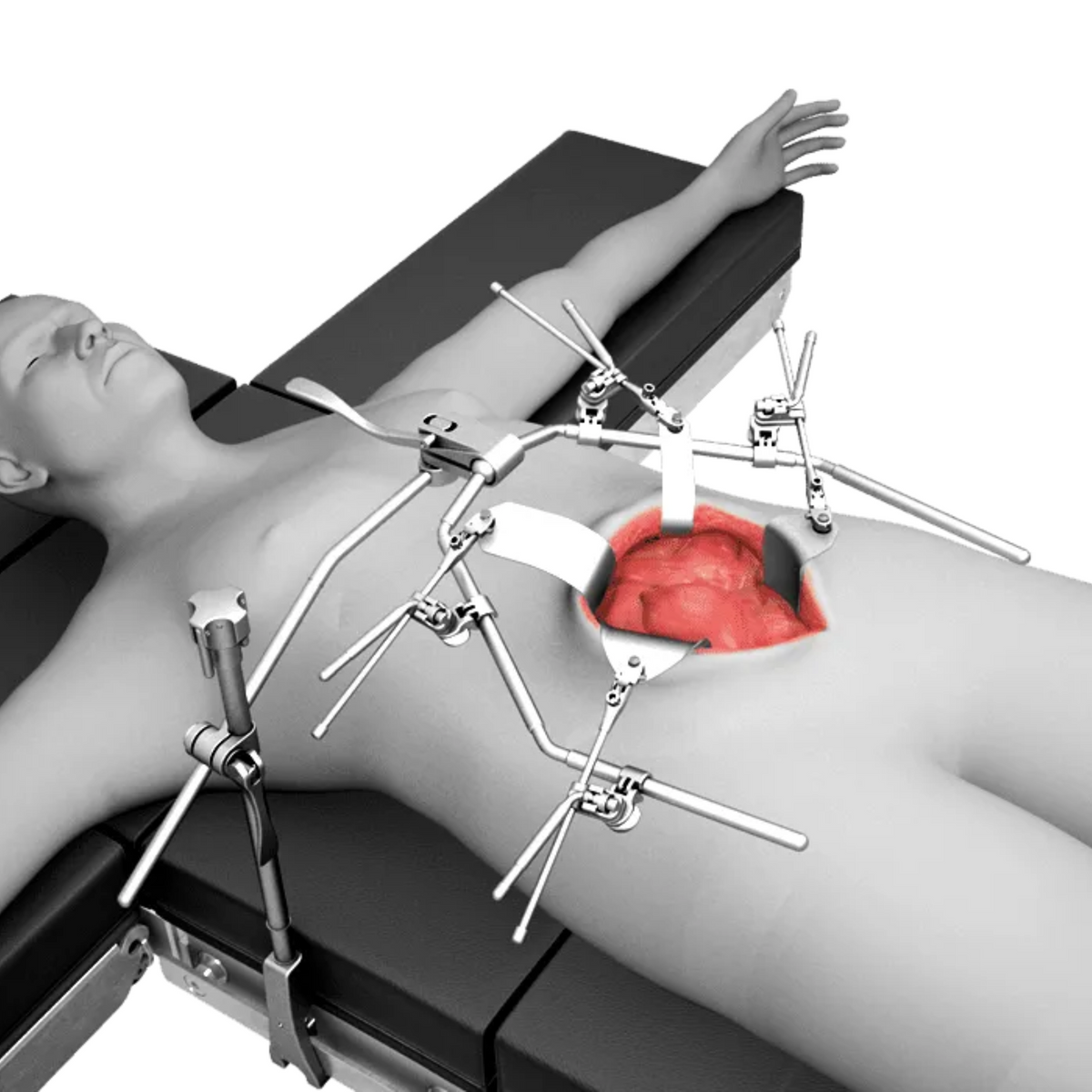 Oneframe Frame Kit – MedScience Distribution